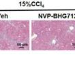 NVP-BHG712在制備用于治療肝纖維化藥物中的用途