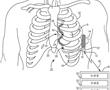 用于檢測心律失常的醫療裝置的制作方法